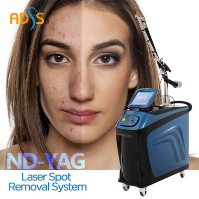 macchina del laser del ND YAG di 1064nm 532nm 755nm per rimozione della pigmentazione