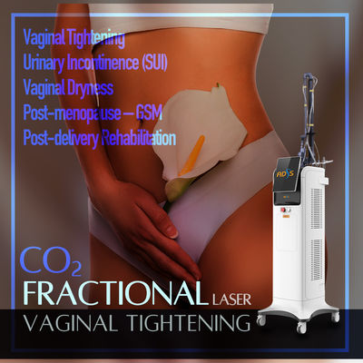 Raffreddamento a aria 10.6um/10600nm della macchina del laser di CO2 di Mark Removal Fractional di allungamento